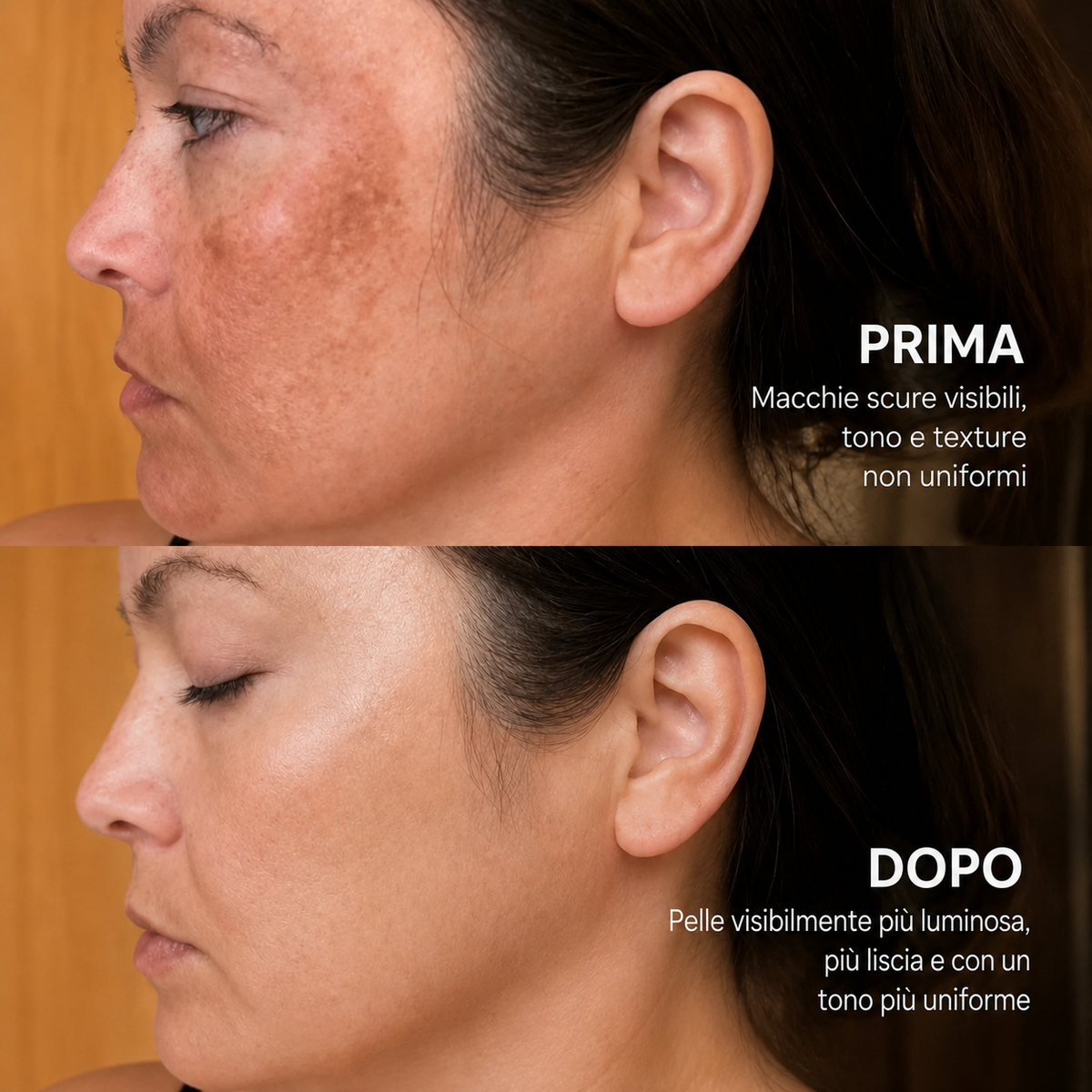 Lumière – Crema Illuminante Anti-Macchie Coreana Avanzata all'Acido Tranexamico
