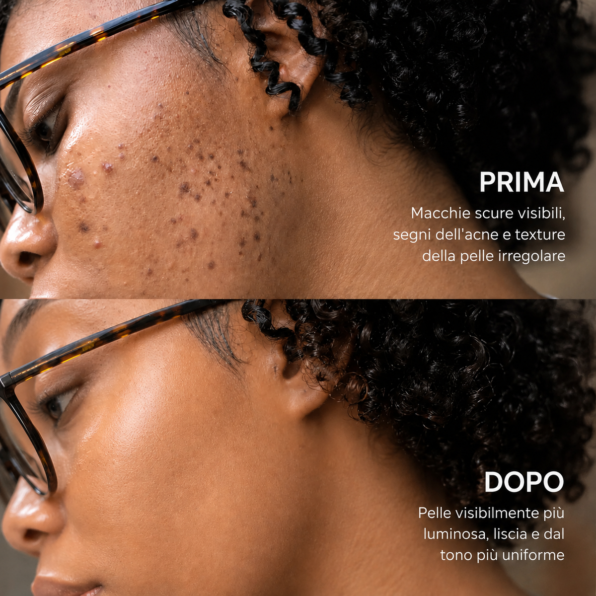 Lumière – Crema Illuminante Anti-Macchie Coreana Avanzata all'Acido Tranexamico