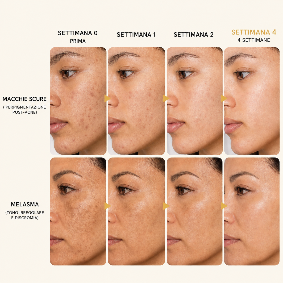 Lumière – Crema Illuminante Anti-Macchie Coreana Avanzata all'Acido Tranexamico